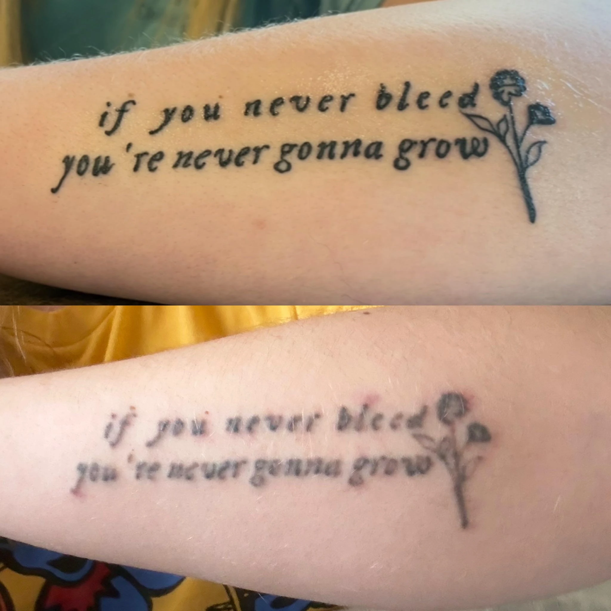 black tattoo before laser removal