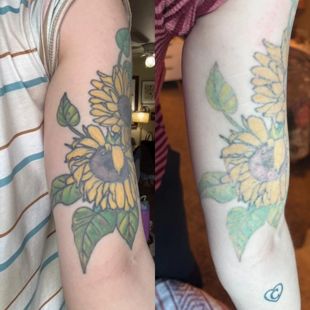 green tattoo after 7 sessions