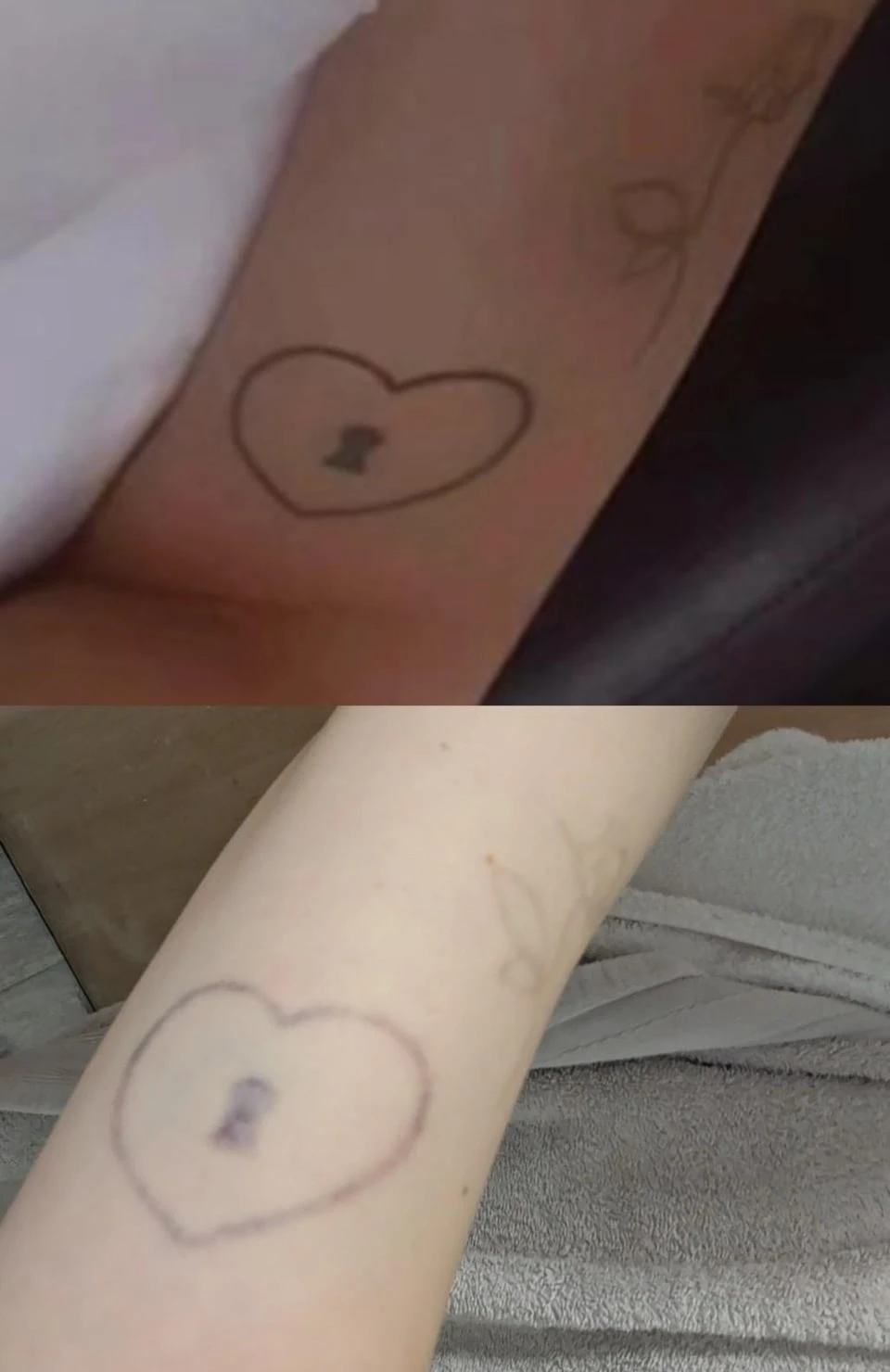 red tattoo after  sessions