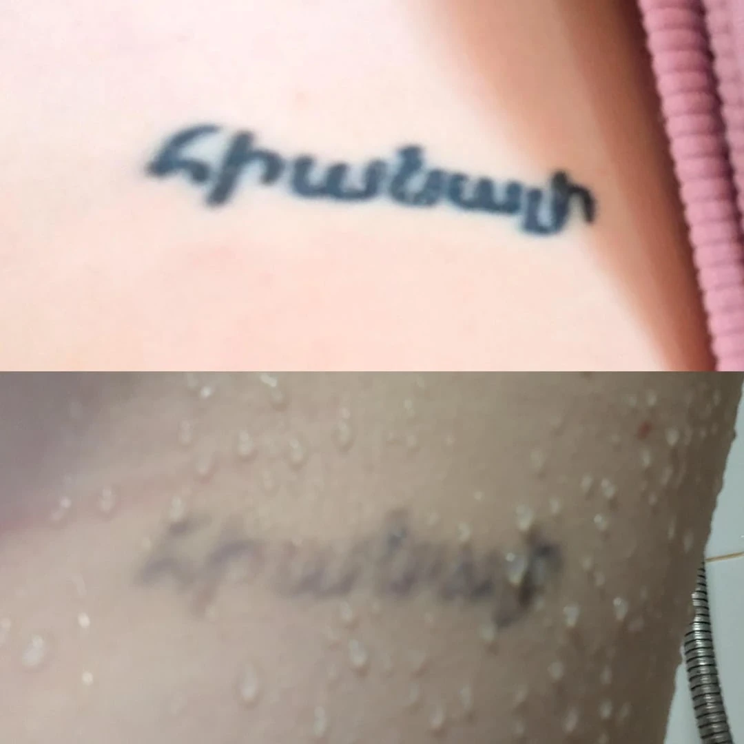 red tattoo before laser removal
