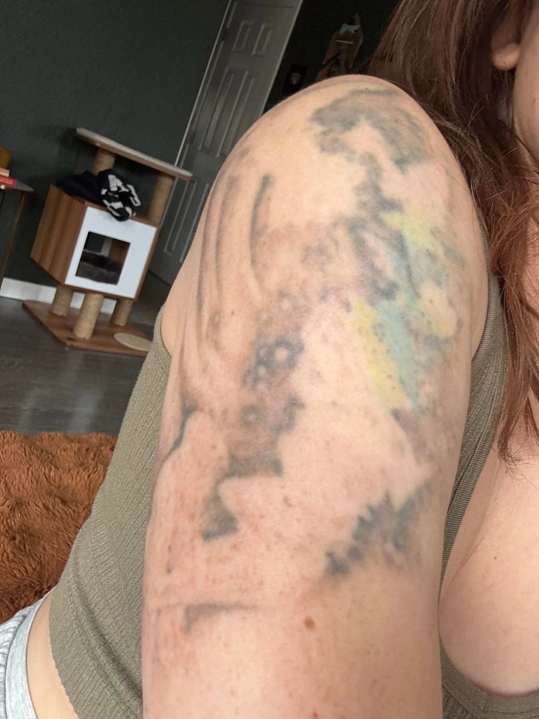 Large Multicolor Upper Arm Tattoo: 50% Fading After 5 Sessions at Removery