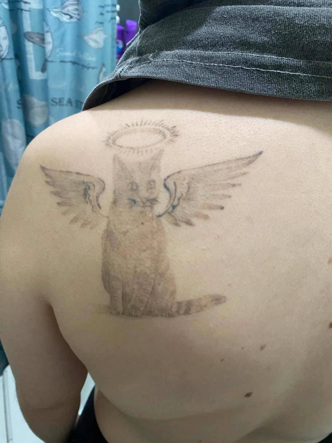 Black And Yellow tattoo session 6 laser tattoo removal