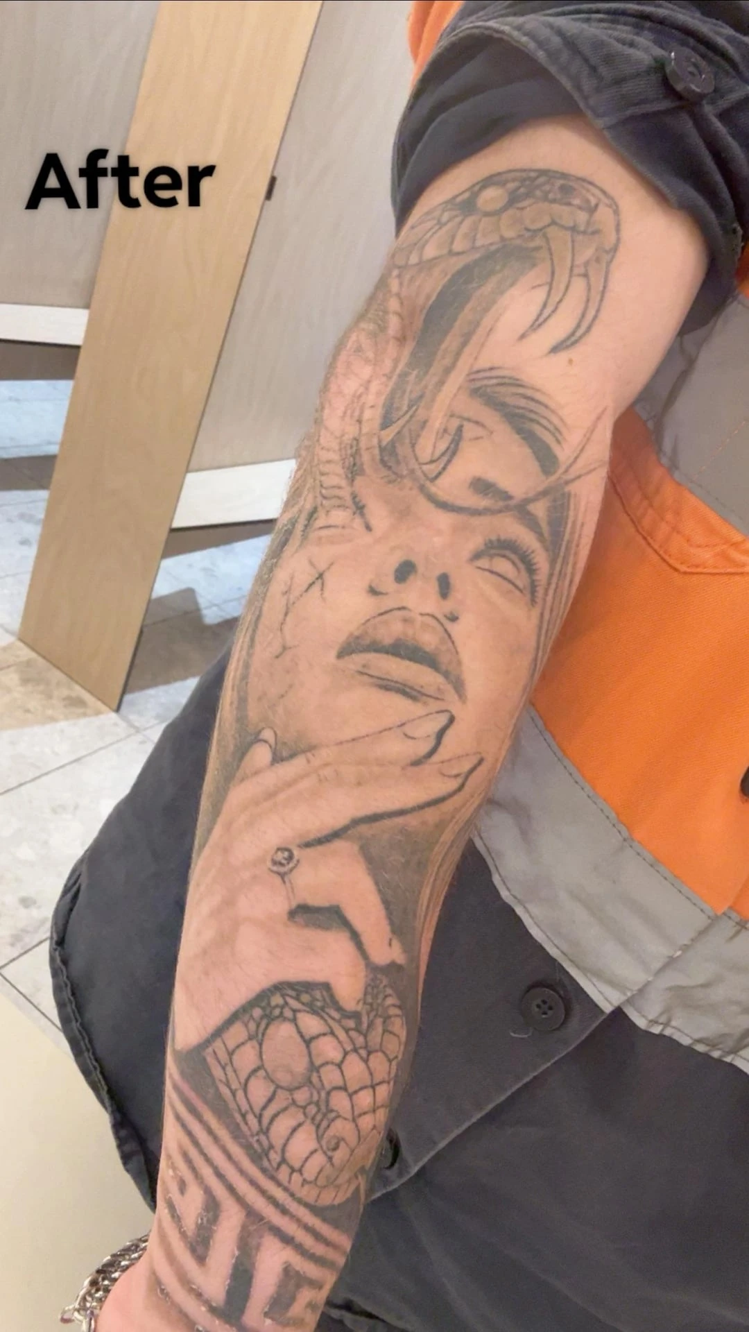 Black tattoo after 1 session