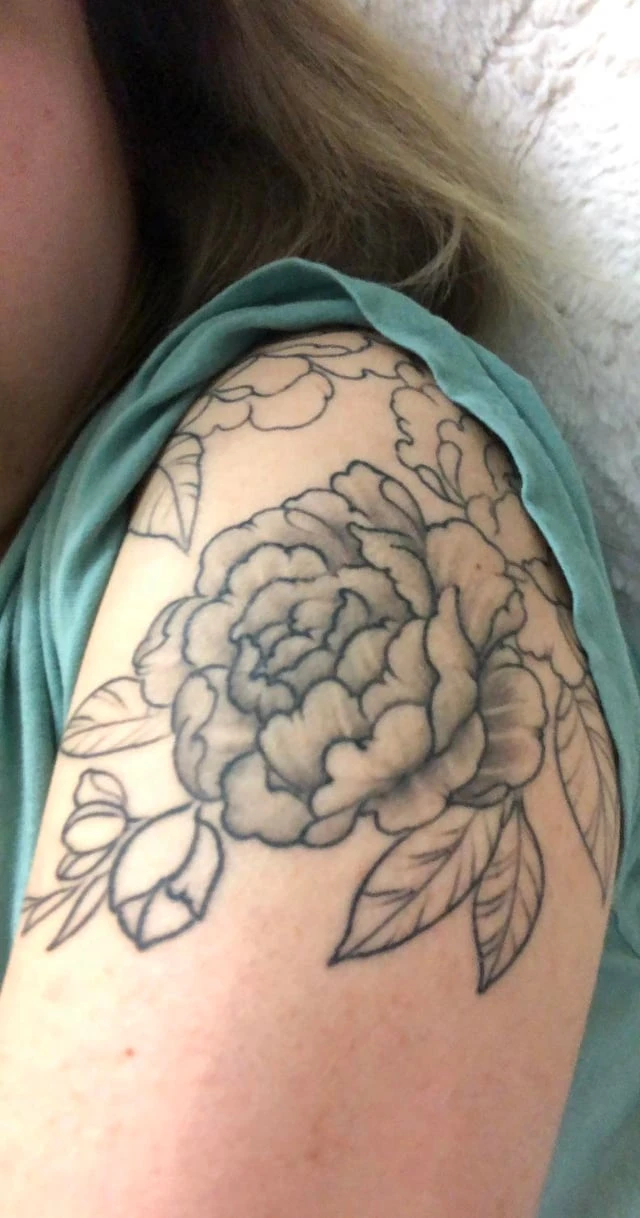 Black tattoo before tattoo removal