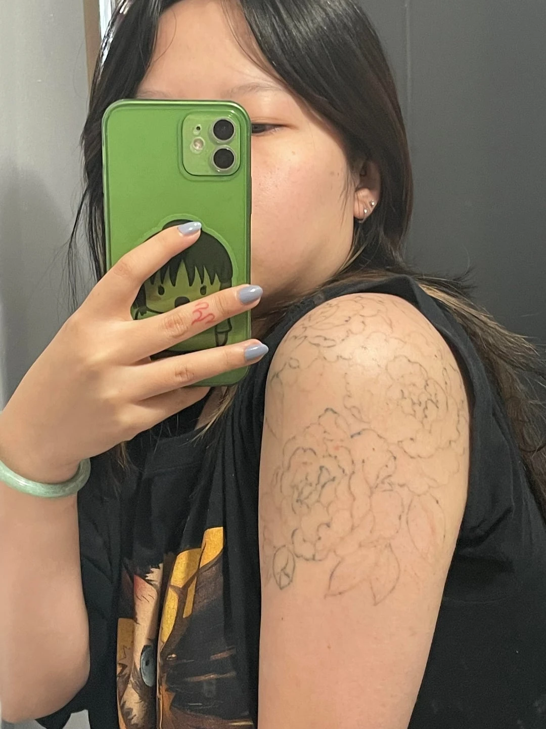 Large Black Tattoo on the Upper Arm, Shoulder, Upper Torso After 4 Sessions: Minimal Visible Change So Far (50% Fading)