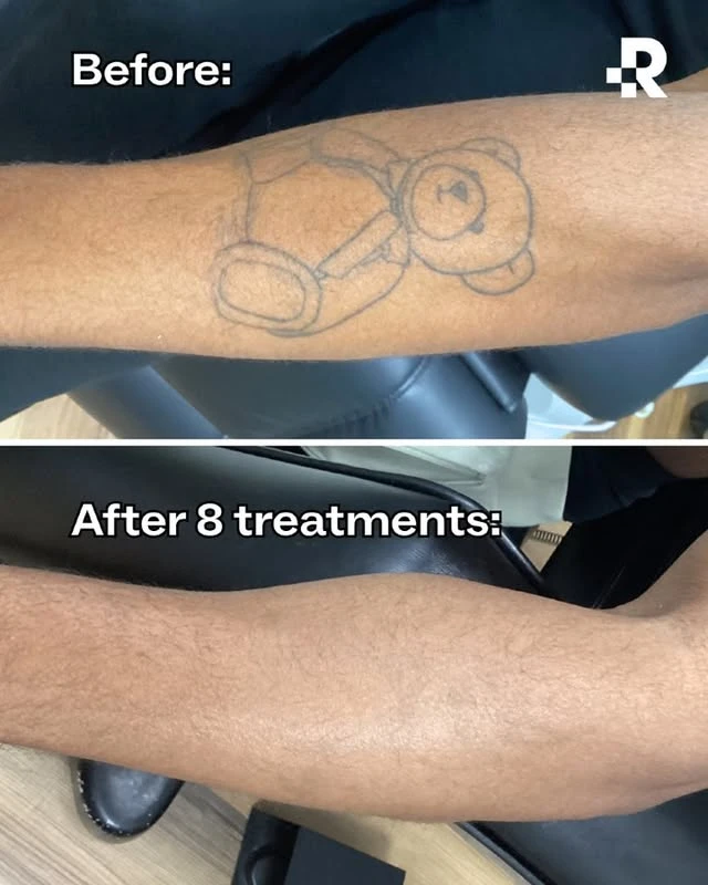 Black tattoo