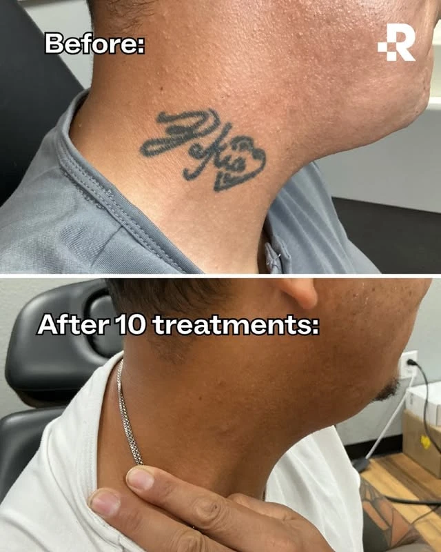 Black tattoo