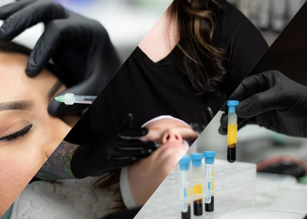 Progress MD Tattoo Removal before and after result 1