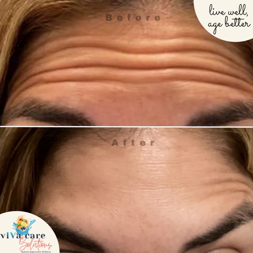 Viva Care Solutions before and after result 1