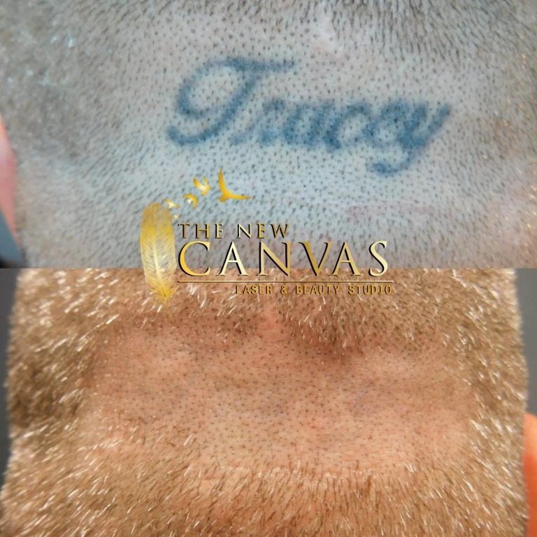 The New Canvas before and after result 1