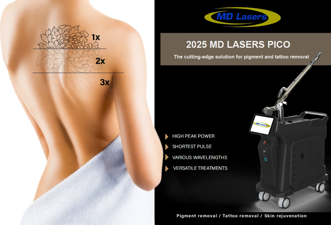 LA Med Spa before and after result 1