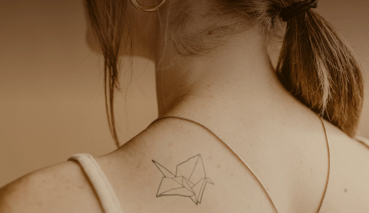 The UnTattoo Parlor before and after result 1