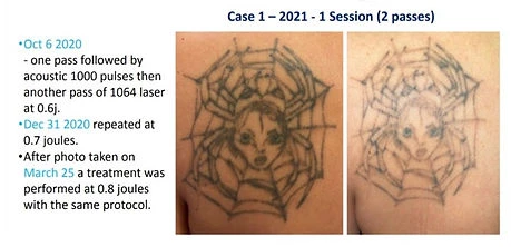 B Dist Inked before and after result 1