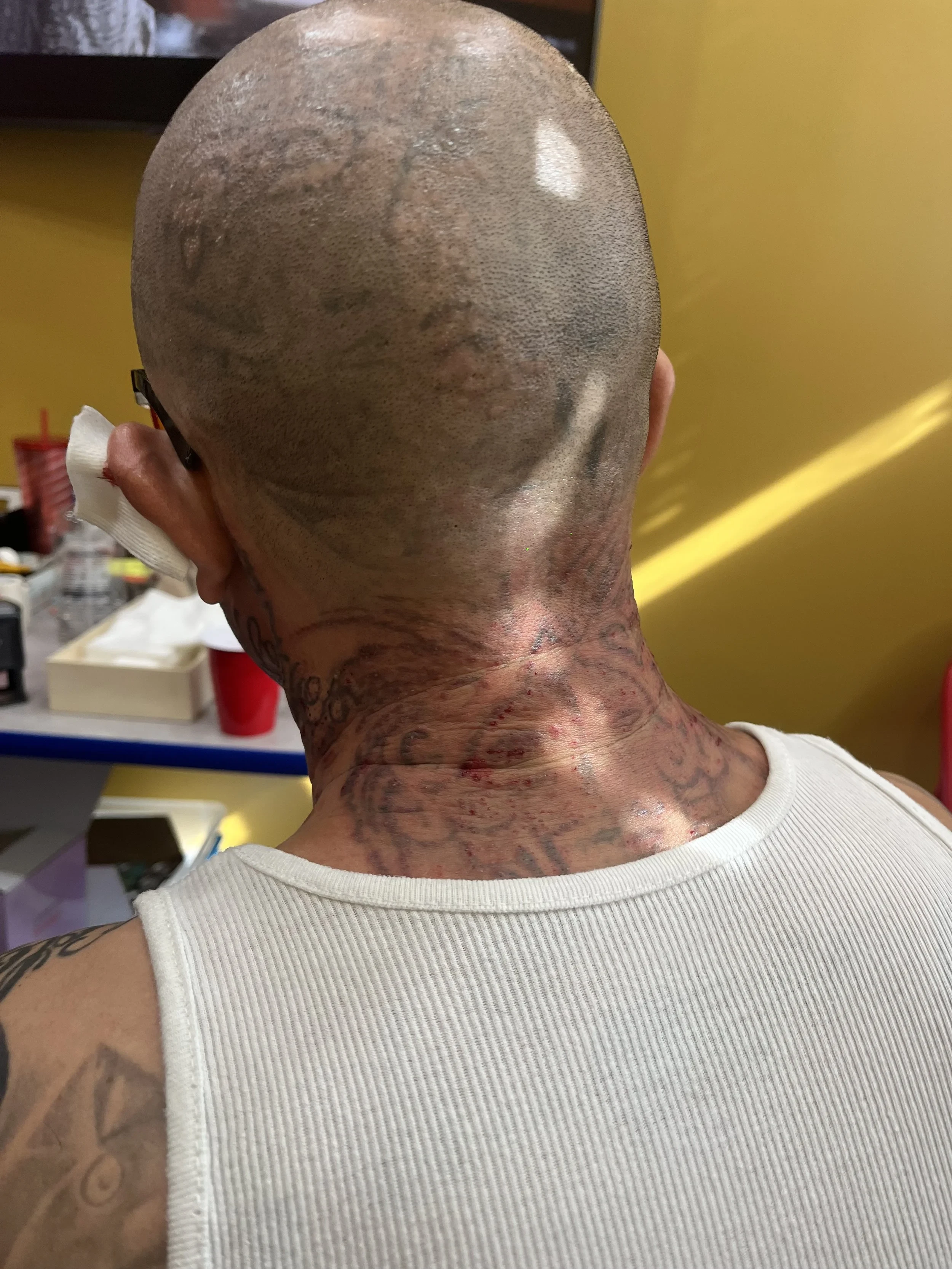 CleanSlate LA before and after result 1