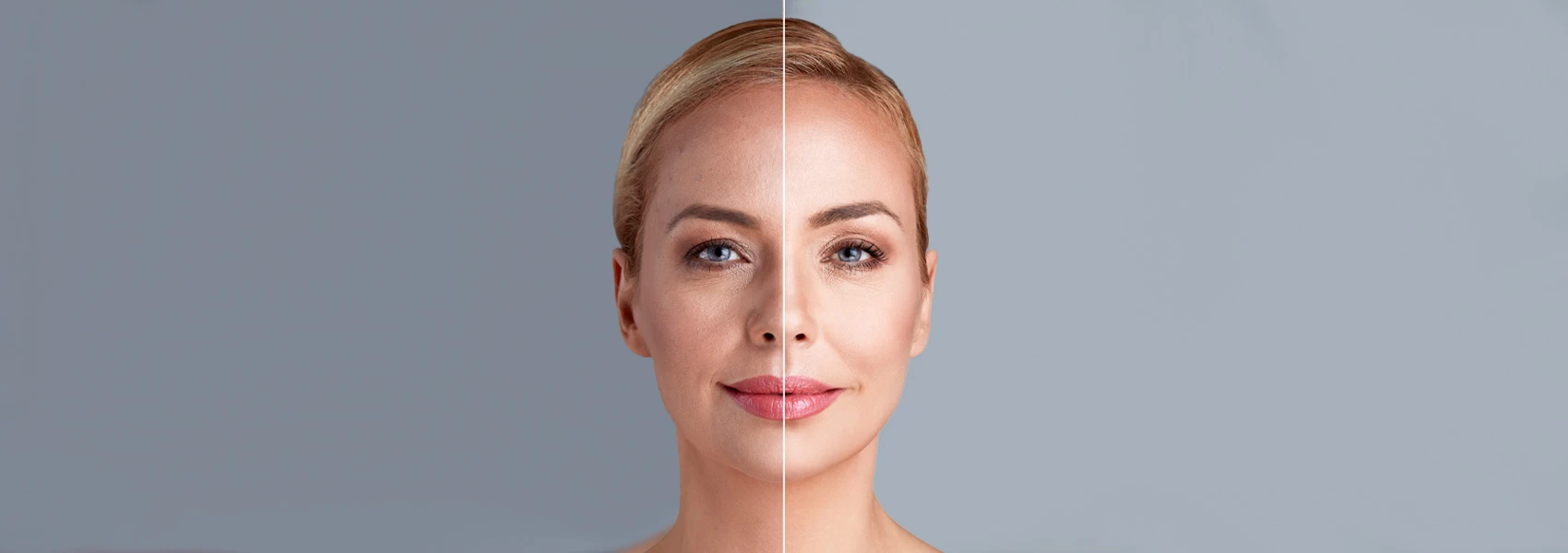 Laser Center Of Orlando before and after result 1
